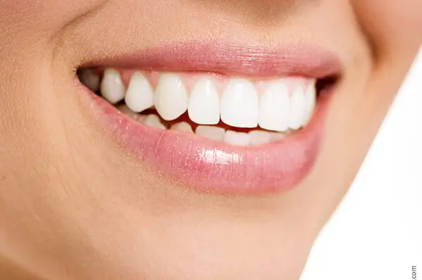 Frau mit gesundem weißen Lächeln nach ästhetischer Zahnbehandlung